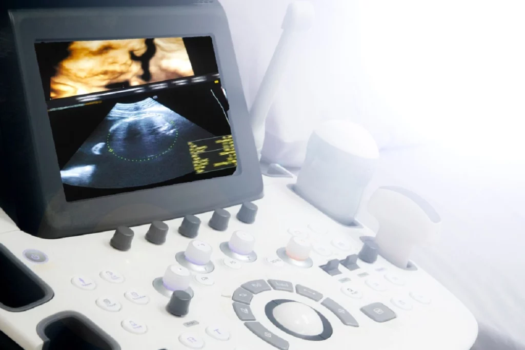 Understanding the 3D Ultrasound
