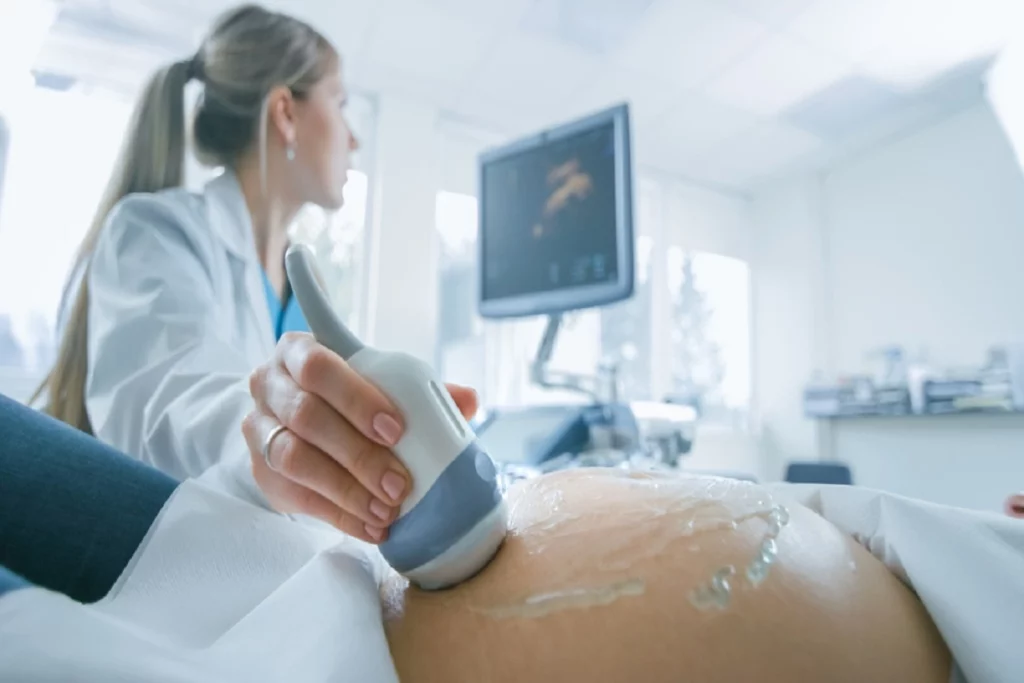 How is A 3d Ultrasound 14 Weeks Performed