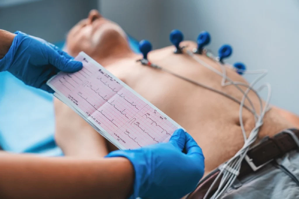 The Fundamentals of an Electrocardiogram